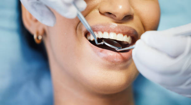 Best Emergency Tooth Extraction in Palermo, NJ